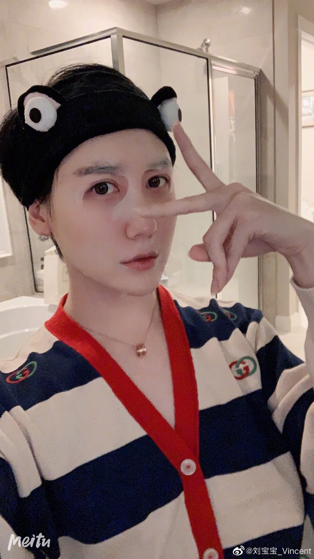 內地「蛇精男」劉梓晨消失3個月自爆全臉毀容!崩潰發文:不知道如何面對我的臉和生活!