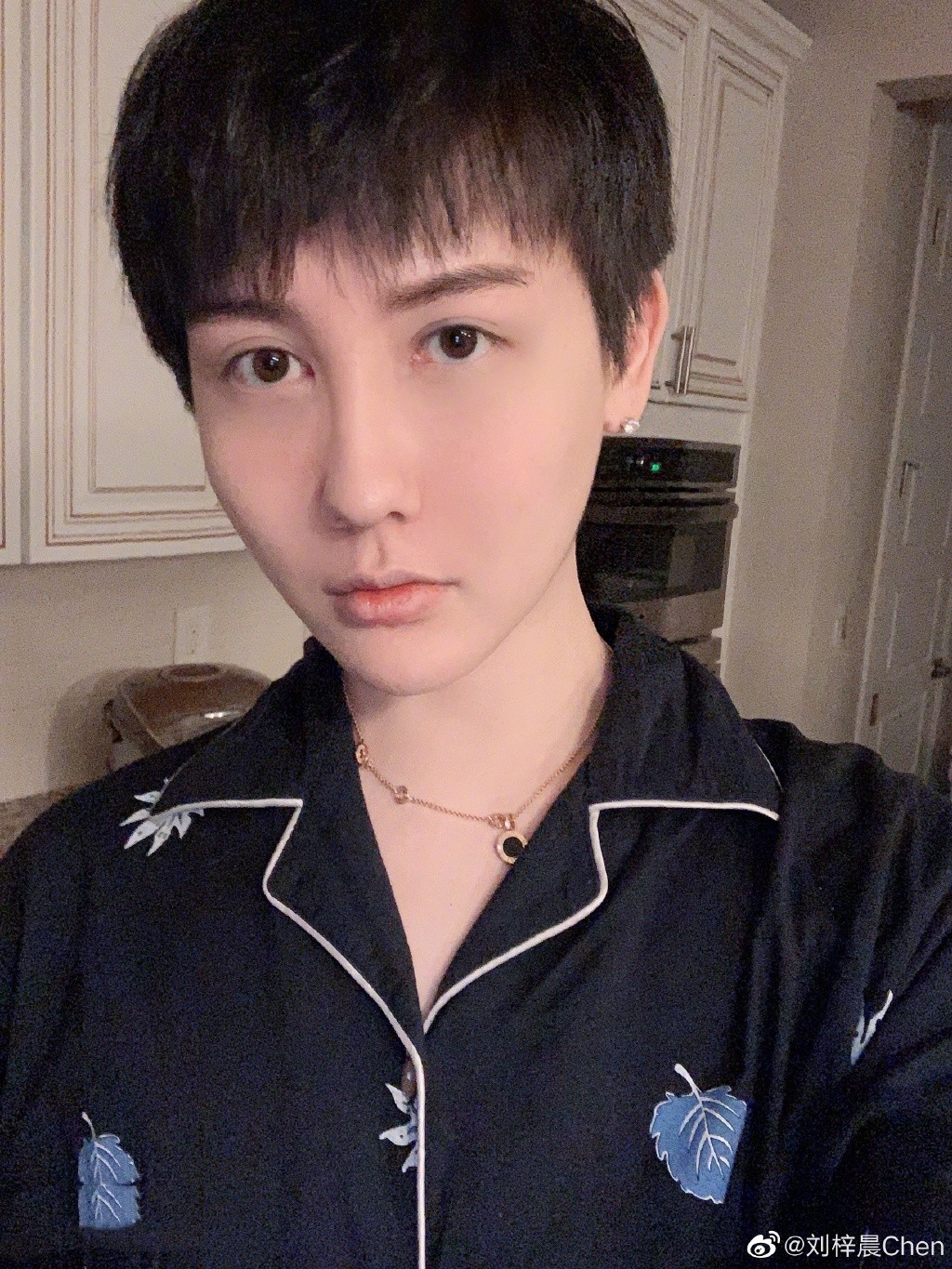 內地「蛇精男」劉梓晨消失3個月自爆全臉毀容!崩潰發文:不知道如何面對我的臉和生活!