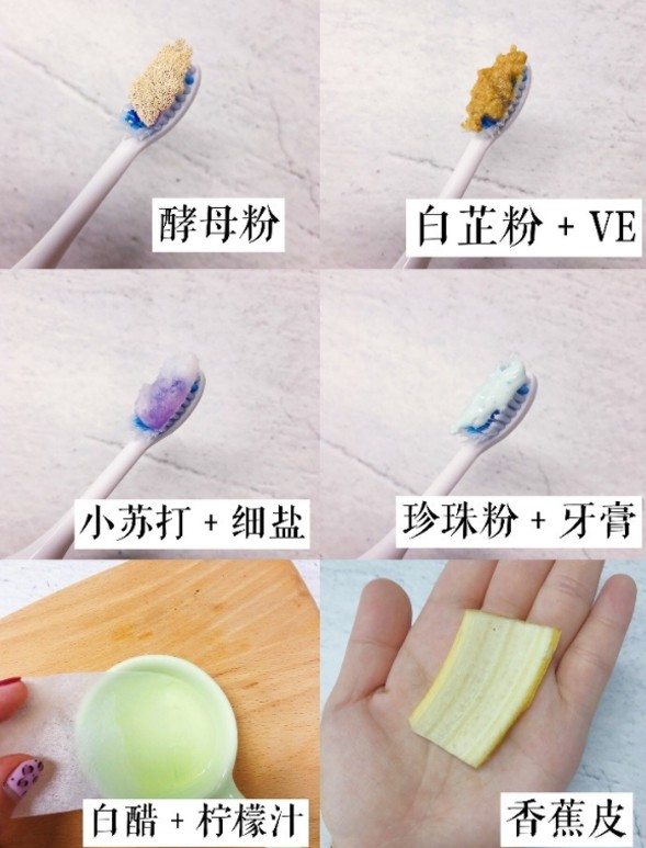 美白牙齒, 牙齒美白, 牙齒保健, 牙齒保養, 藍光牙齒美白, 美牙儀,