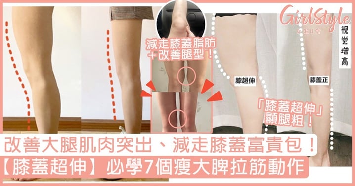【瘦大脾方法】「膝超伸」顯腳粗？必學7個拉筋動作，改善大腿側突出、減走膝蓋脂肪！