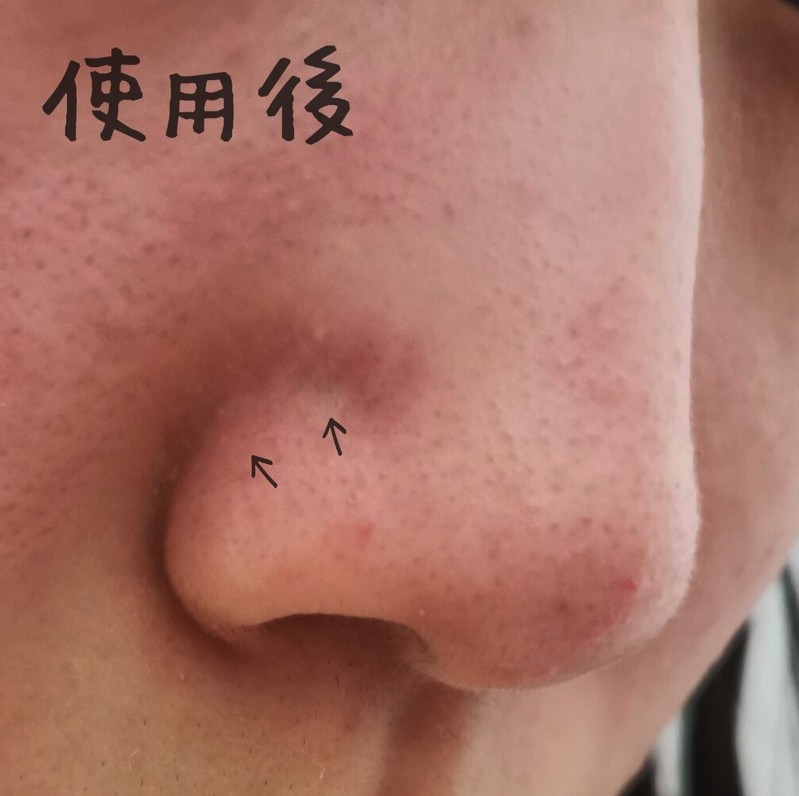 日本大賣,回購不斷,Daiso好物,去黑頭,收毛孔