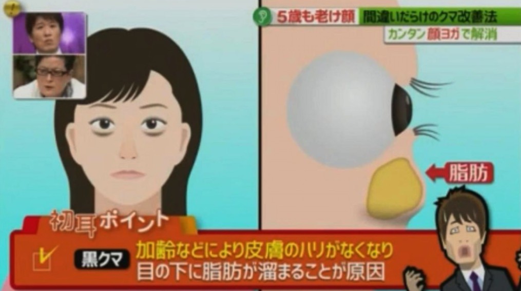 黑眼圈顏色,去黑眼圈,黑眼圈形成,日本醫生