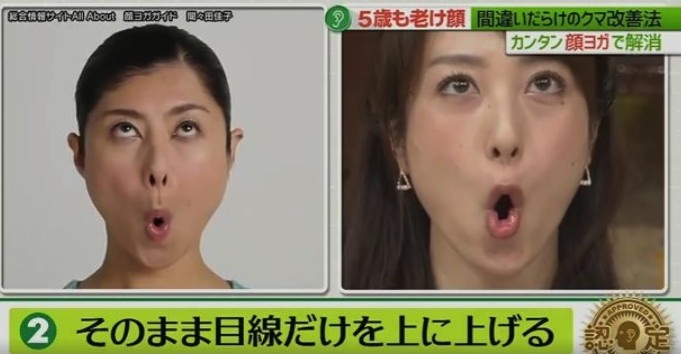 黑眼圈顏色,去黑眼圈,黑眼圈形成,日本醫生