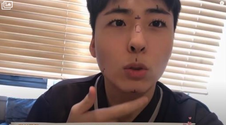 韓男為變朴寶劍動刀全臉整!