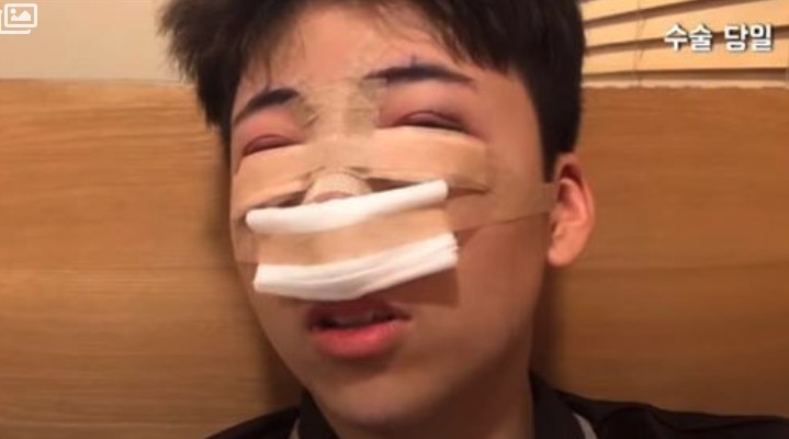 韓男為變朴寶劍動刀全臉整!