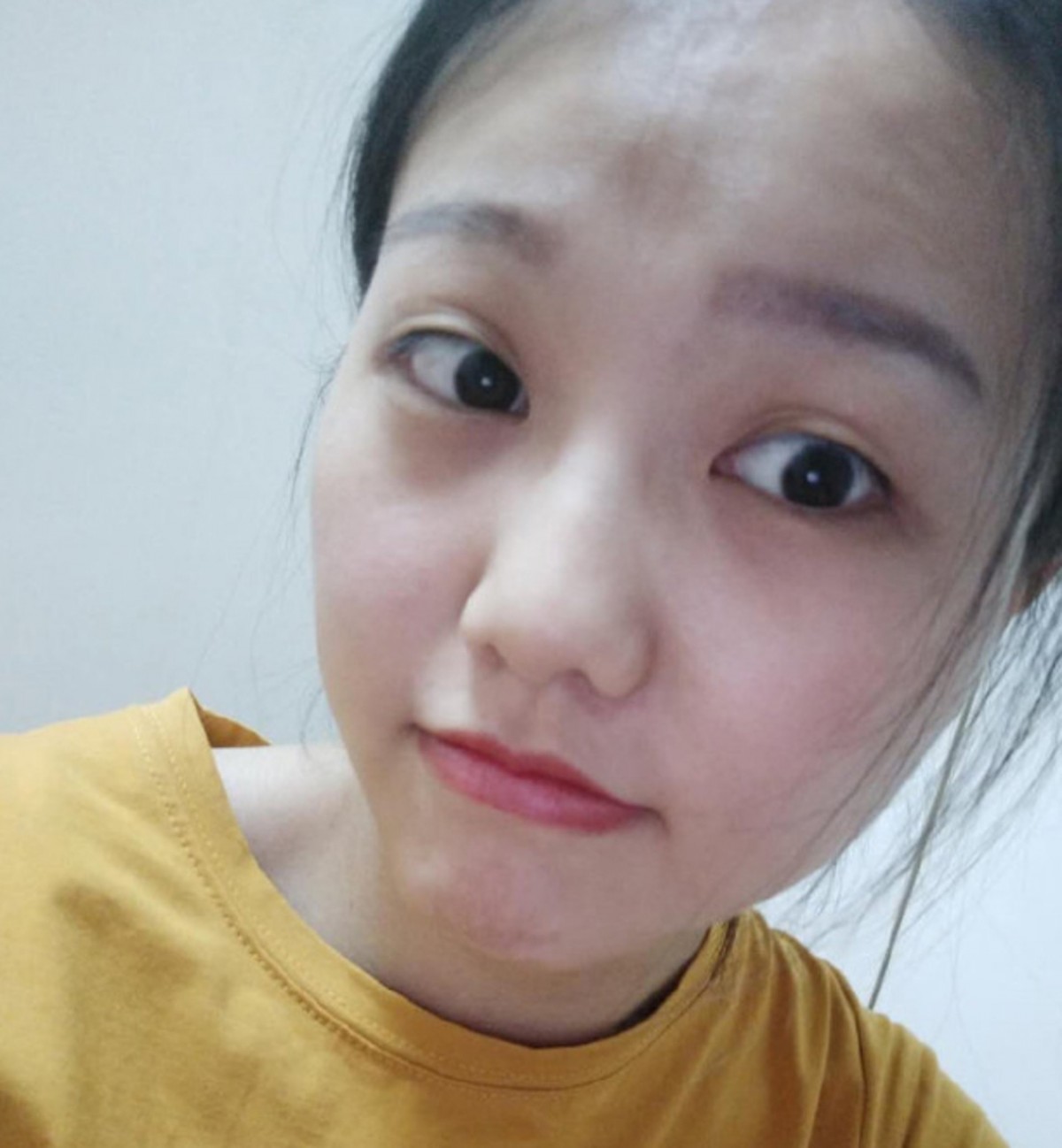 內地女生微博分享整容Before&After!隆鼻縮鼻翼/削骨/雙眼皮效果超驚人