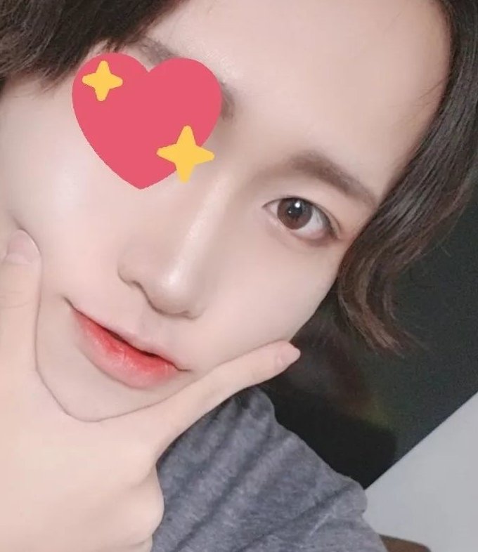 【偽娘整容】因為覺得自己的單眼皮很沒有神,於是就去整容,做成了深邃的雙眼皮,無辜大眼讓自己更顯可愛