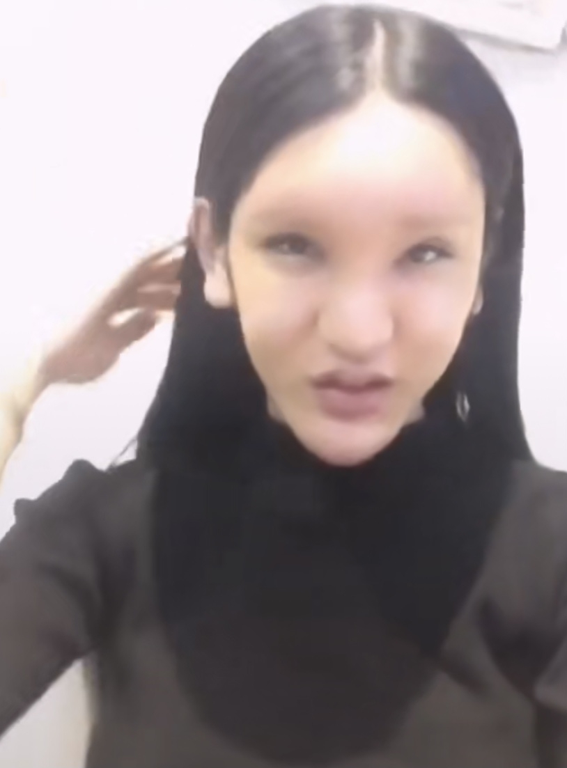 桃花寶寶33鼻子也因為女性的肋骨比較軟所以很快就歪掉,下巴也開始出現凹凸紋,胸部和臀部也經常因為填充物消化掉,縮小然後導致不對稱。