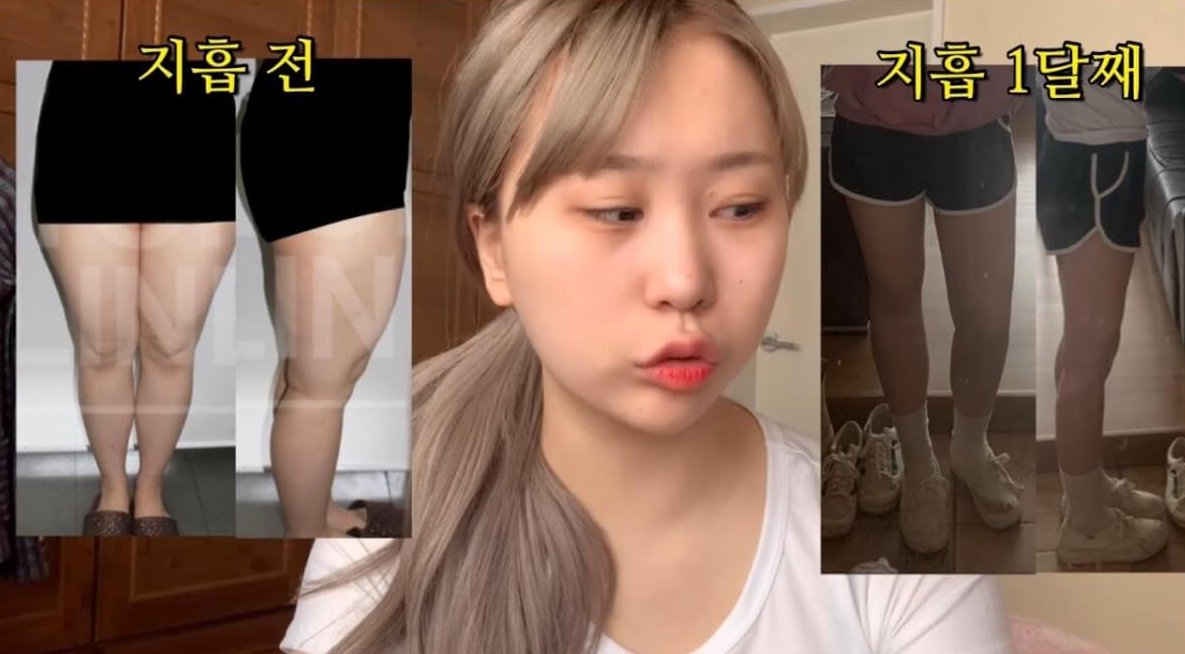 現在已經由醜小鴨蛻變成自信女生的趙秀珍,因為隨和大方的個性深得不少粉絲歡心,更完全不介意以術後的真實樣子見人