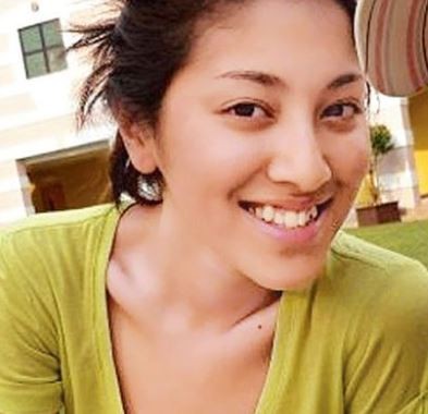 【陳凱琳】陳凱琳以前都有牙齒不整齊的情況,一張開口笑,就可以清楚看到一排亂牙的樣子,特別上排牙齒至少有三隻爆牙。