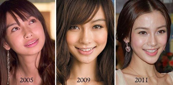 ANGELABABY_整容