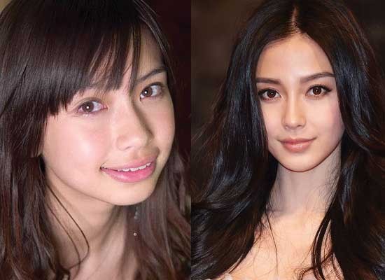 ANGELABABY_整容