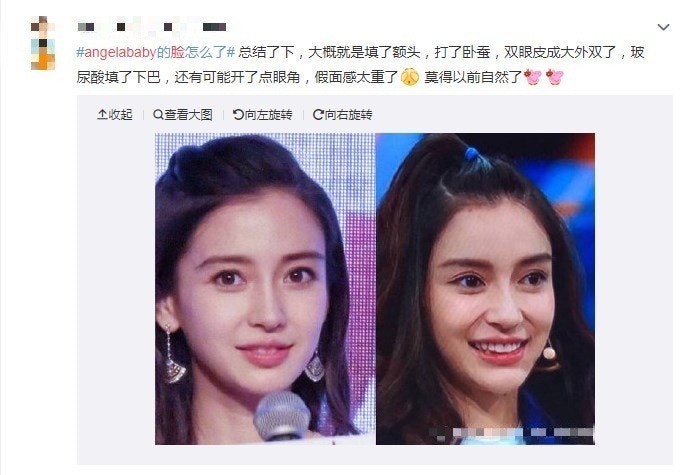 ANGELABABY_整容_抖音