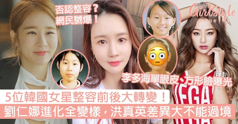 5位韓國女星整容前後轉變 劉仁娜全變樣 洪真英差異大不能過境 Girlstyle 女生日常