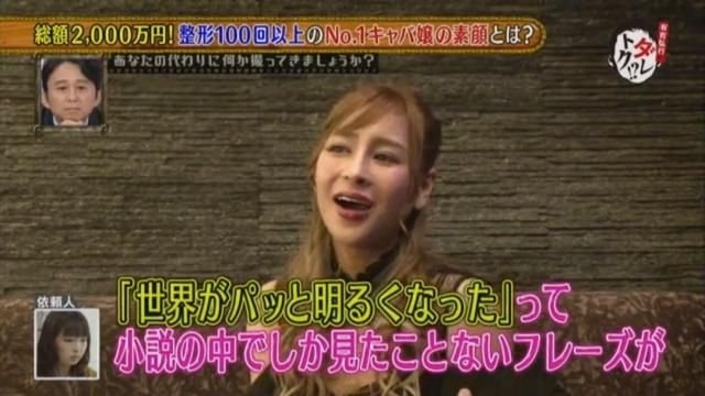 【整容】不過原來「櫻井野之花」能擁有如此漂亮精緻的五官,這全都是靠她後天加工才得來。她亦曾大方在電視節目中大爆她的整容經歷