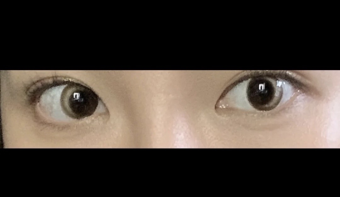月牙形美瞳Con中伏出事/戴上變鬥雞眼傻仔/千萬不要買