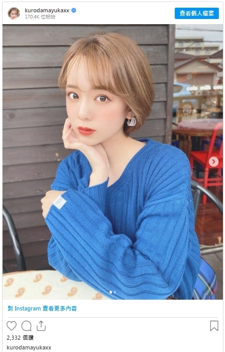 【V面輪廓】Juvederm「美感密碼概念療程」一反過往透明質酸的療程,它是專門針對輪廓的整體協調度,不再是追求局部的美感,以超創新且女性常追求的8大情感改善為目標