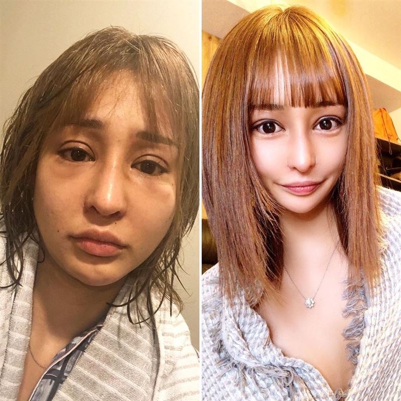 【整容】整容過後的「櫻井野之花」開始充滿自信,而且更愈整愈上癮,似是停不了般!有網民更認為「櫻井野之花」的樣子像是每個月都有超大的轉變