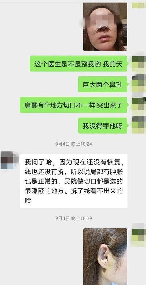 最近內地就有一名 31 歲的女生，為了讓鼻型看起來更完美選擇動刀，但最後竟然得不償失，結果賠了鼻子更折了耳朵？