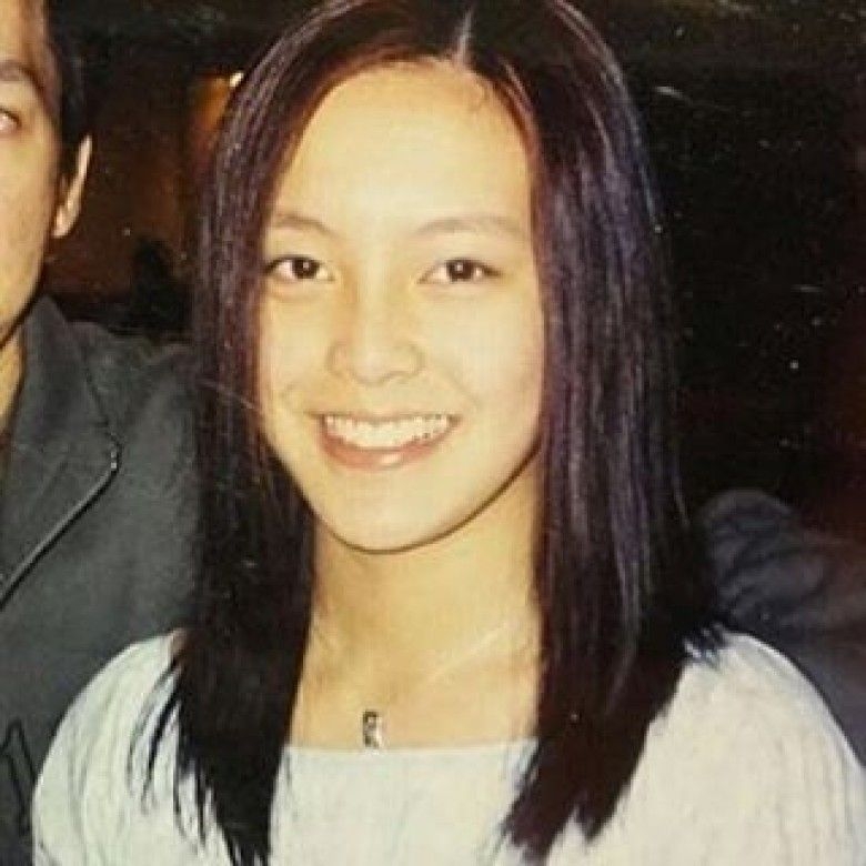 雖然張曦雯的童年照與現時的樣子幾乎很相似,但是卻曾陷入整容疑雲風波,當年因網民翻出過去張曦雯多張單眼皮的舊照,多次質疑她整容才變美