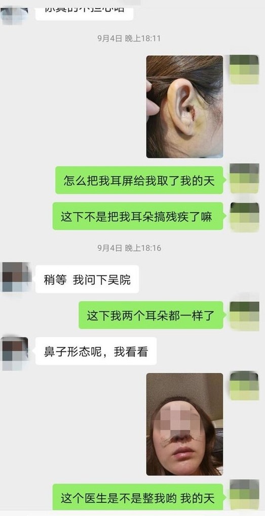 最近內地就有一名 31 歲的女生，為了讓鼻型看起來更完美選擇動刀，但最後竟然得不償失，結果賠了鼻子更折了耳朵？