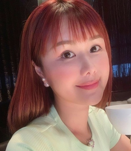 同為大熱港姐的不過當年落選的劉思希,也在劇集《迷》中演過哨牙角色。當時她的造型也頂著一頭冬菇短髮,雖然牙不太哨,但牙肉還比牙齒突出。其油頭大口的「小丑」look當時也為她增添了不少名氣。本身的她其實有個櫻桃小嘴而且氣質非常清純,看起來很整潔,完全不像角色般邋遢。