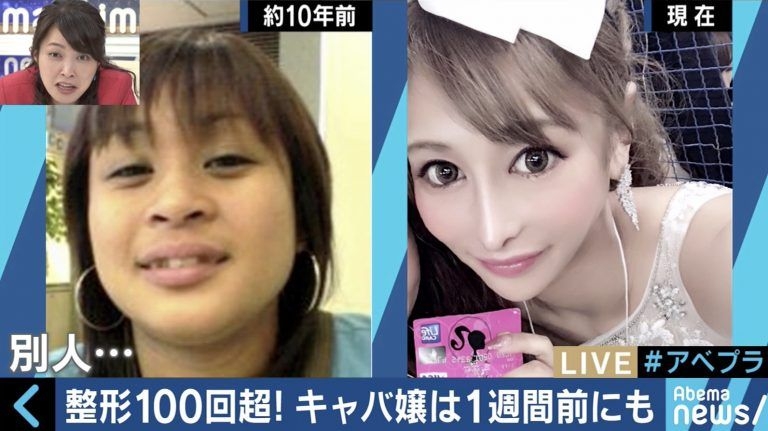 【整容】「櫻井野之花」更公開過自己整容前的相片,不少網民都表示:「完全看不出是同一個人,沒有一個部位相似...」