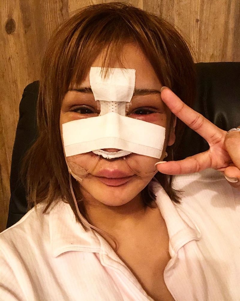 【整容】整容過後的「櫻井野之花」開始充滿自信,而且更愈整愈上癮,似是停不了般!有網民更認為「櫻井野之花」的樣子像是每個月都有超大的轉變