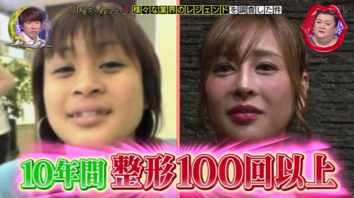 【整容】不過對此「櫻井野之花」並沒有理會,反而表示開始時想整容變成石原里美,到早前就想變成廣瀨鈴,而自己接下來的目標是想變成橋本環奈。