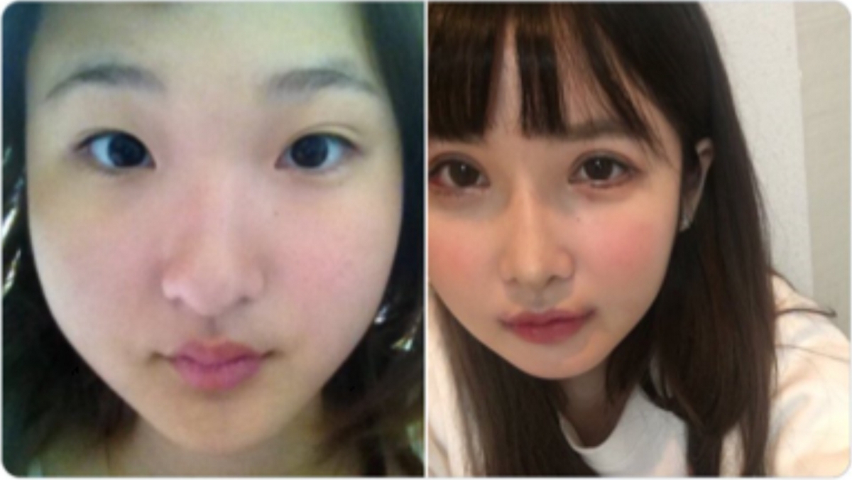 【整容後遺症】在16歲那年,ikiri就寫了一封信給媽媽,告知她想要去整容,最後得到媽媽允許下而去割了雙眼皮