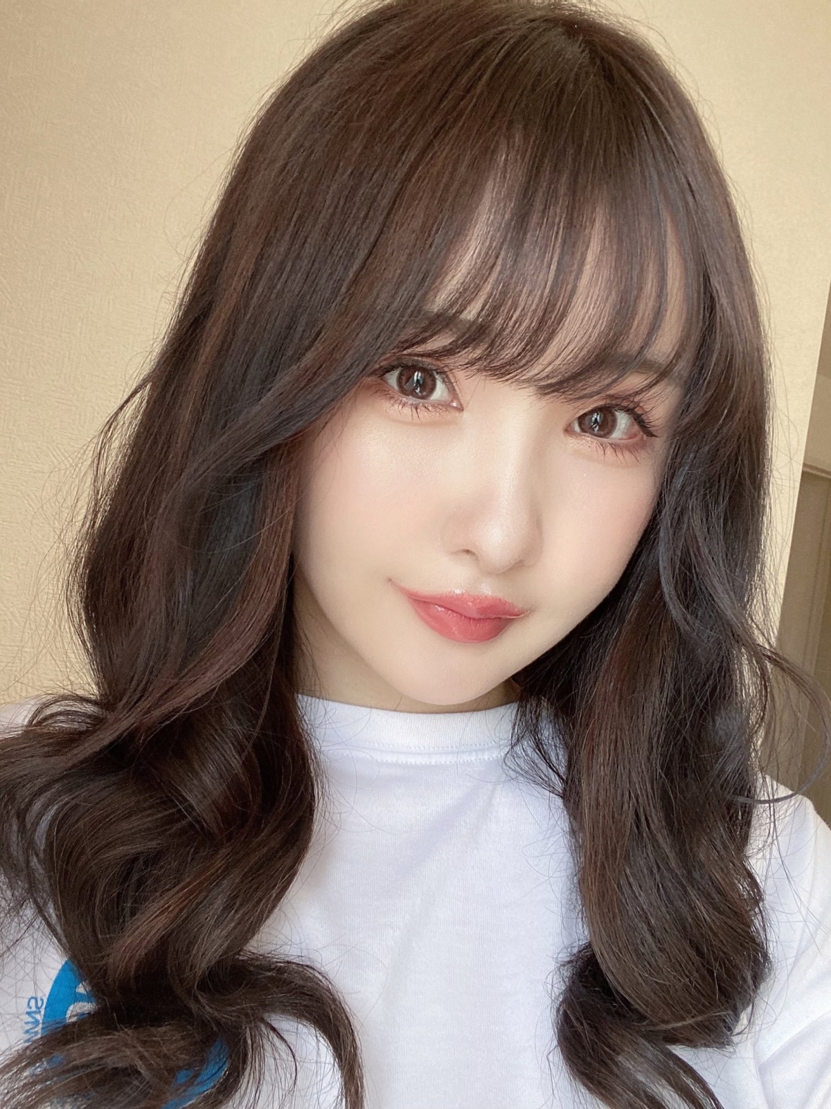 【整容後遺症】手術後的她整個顏值也大升級,變成了網紅臉~