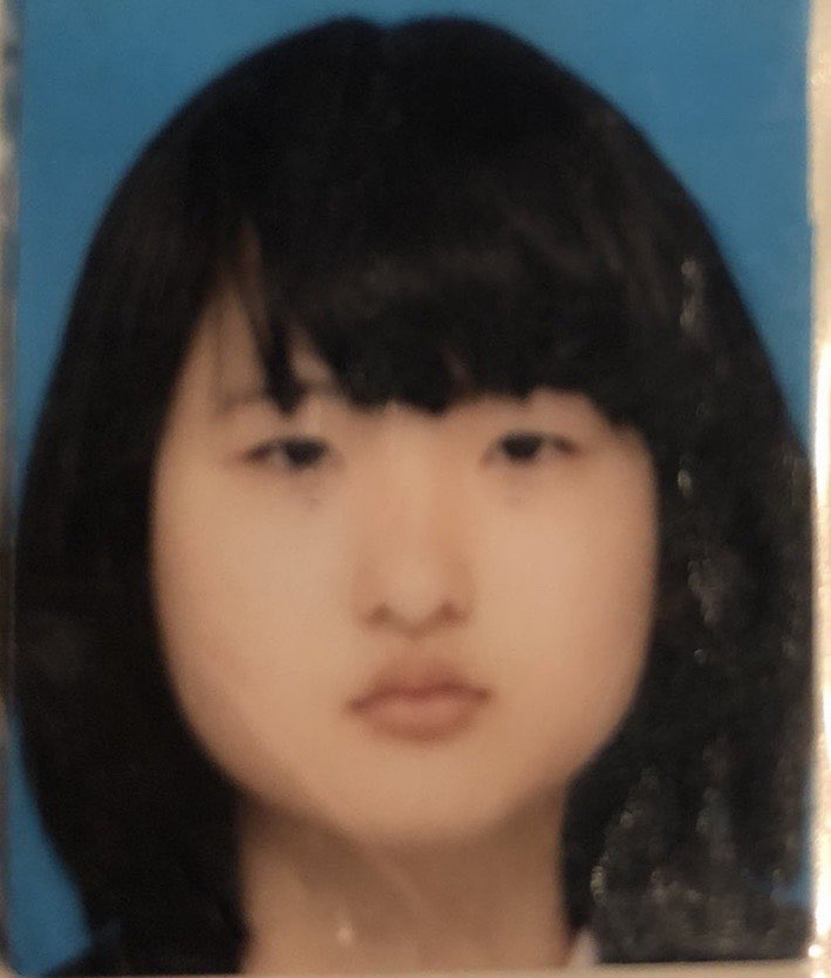 【整容後遺症】這位日本女生ikiri其實早在小學三年級時就已經發現自己的雙眼一邊是單眼皮,另一邊是雙眼皮,出現不對稱的情況