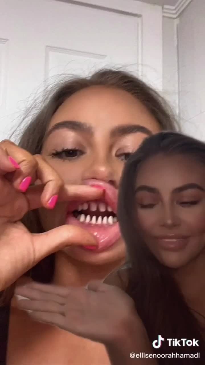 近日的抖音上就出現了一個＂Shark Teeth＂（鯊魚牙齒）新熱潮，