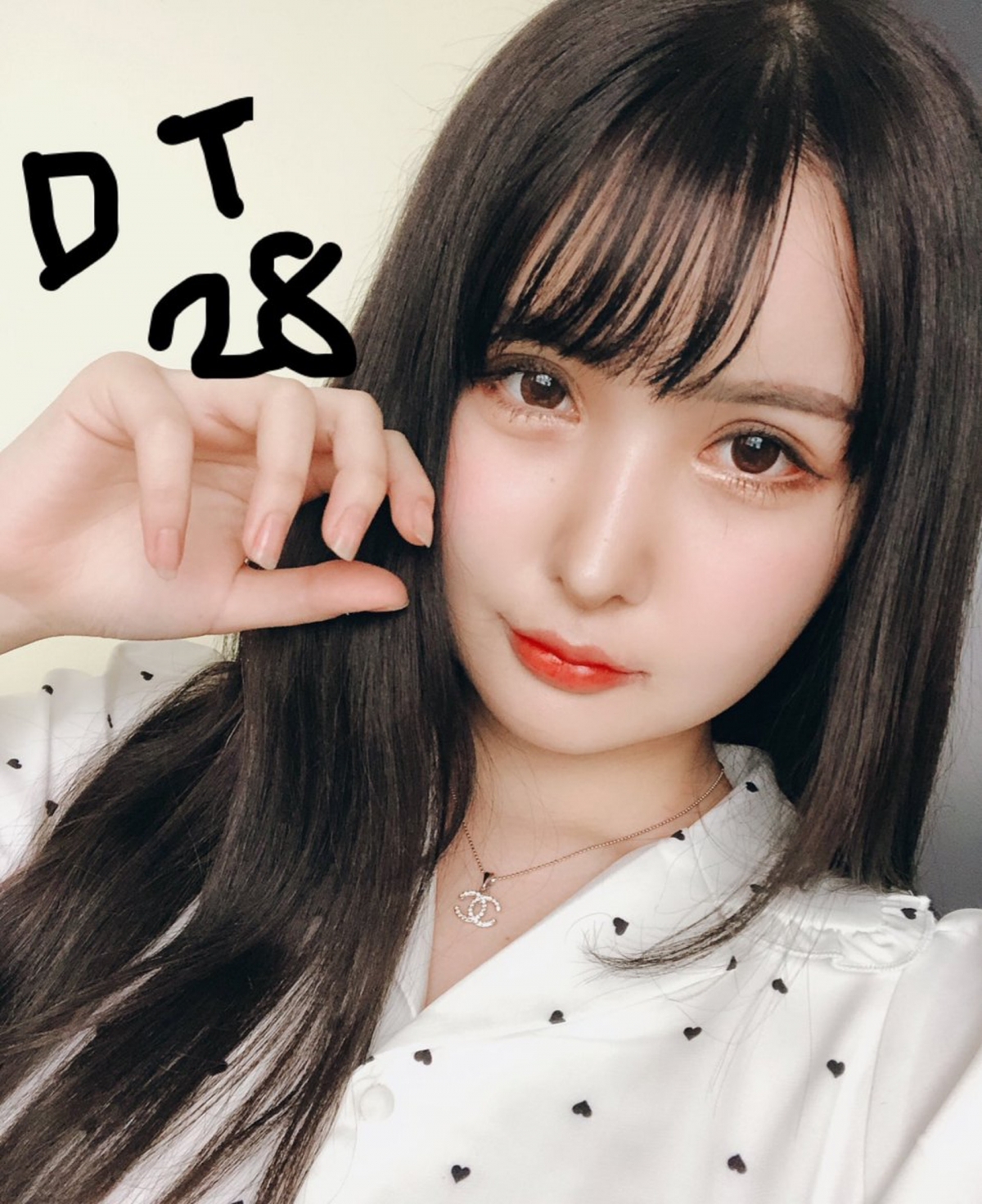 【整容後遺症】ikiri更表示自己共花了1500萬日圓(約110萬港幣)整容