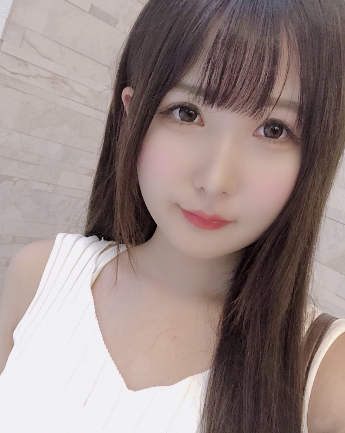 【整容後遺症】這手術後也令她與家人的關係大大的改善了!現時,家人亦接受了她整容的事實。