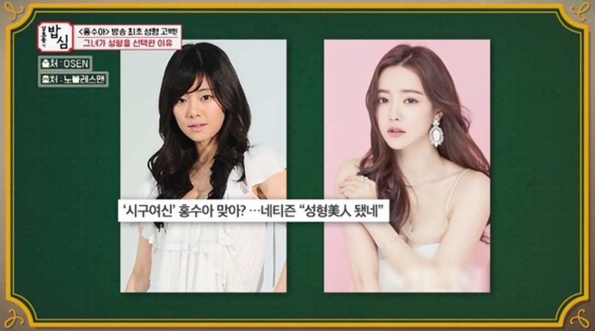 她對於自己的樣子並不滿意,而且後來事業也發展得不順,只得配角的角色演,星途黯淡。她就決定走上整容之路,在2013年時參演的《戀愛的技術》,雖然已經動刀,但是她特色的單眼皮還在,但是也讓她不滿足。