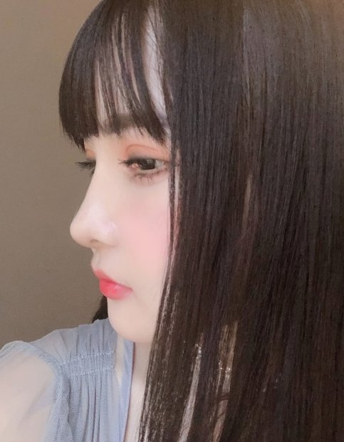 【整容後遺症】雖然這話對她來說是一種支持,但是因不想再在整容問題而跟家人爭吵,她隨後的整容手術都沒有告知家人。