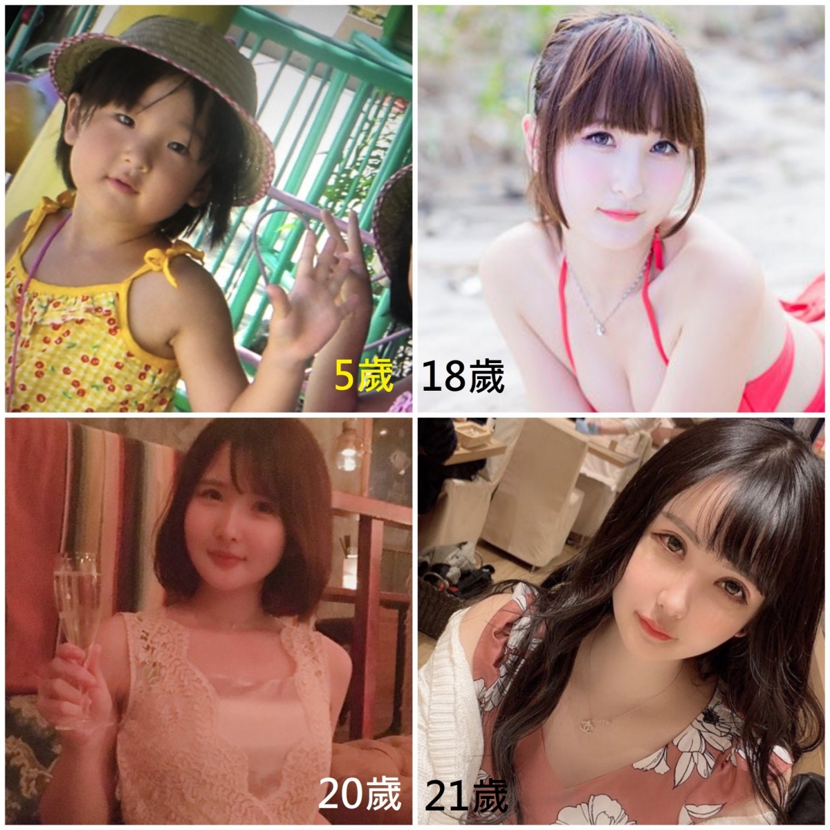 【整容後遺症】除了臉部,更有去豐胸,以抽脂手術的方式注射到乳房內,令身材變得更誘人。