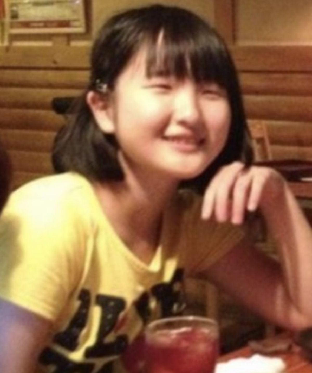 【整容後遺症】日本有位女生いきりちゃん(ikirichan)因在16歲時被爸爸狠笑樣子不好看,直言「你的樣子會帶來不幸」