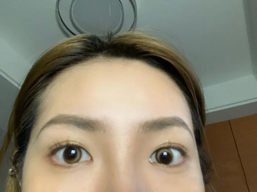 繼「月牙形美瞳」被嘲戴上後似智障後