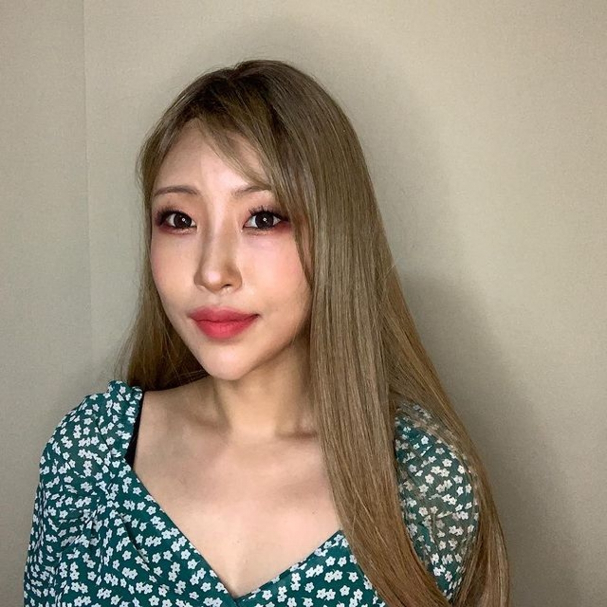 近日終於康復並回歸以美貌自信示眾，她搖身一變變成了一位美女，眼睛除了變得又大又水汪汪之外，也有網民指她的下巴和鼻子也變得不少，猜測她除了眼睛之外還有整其他地方。