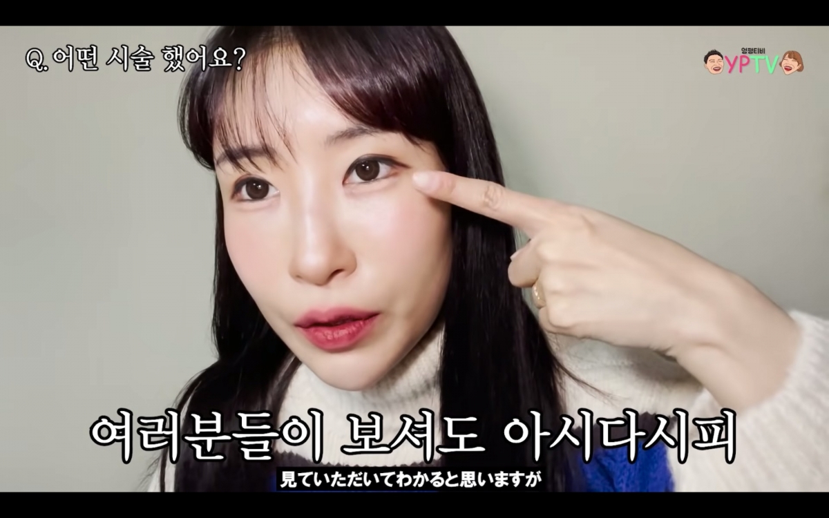 不理男友的反對，她決定做盡所有眼部整容手術，包括割雙眼皮、眼形矯正、開眼頭和開眼尾手術。