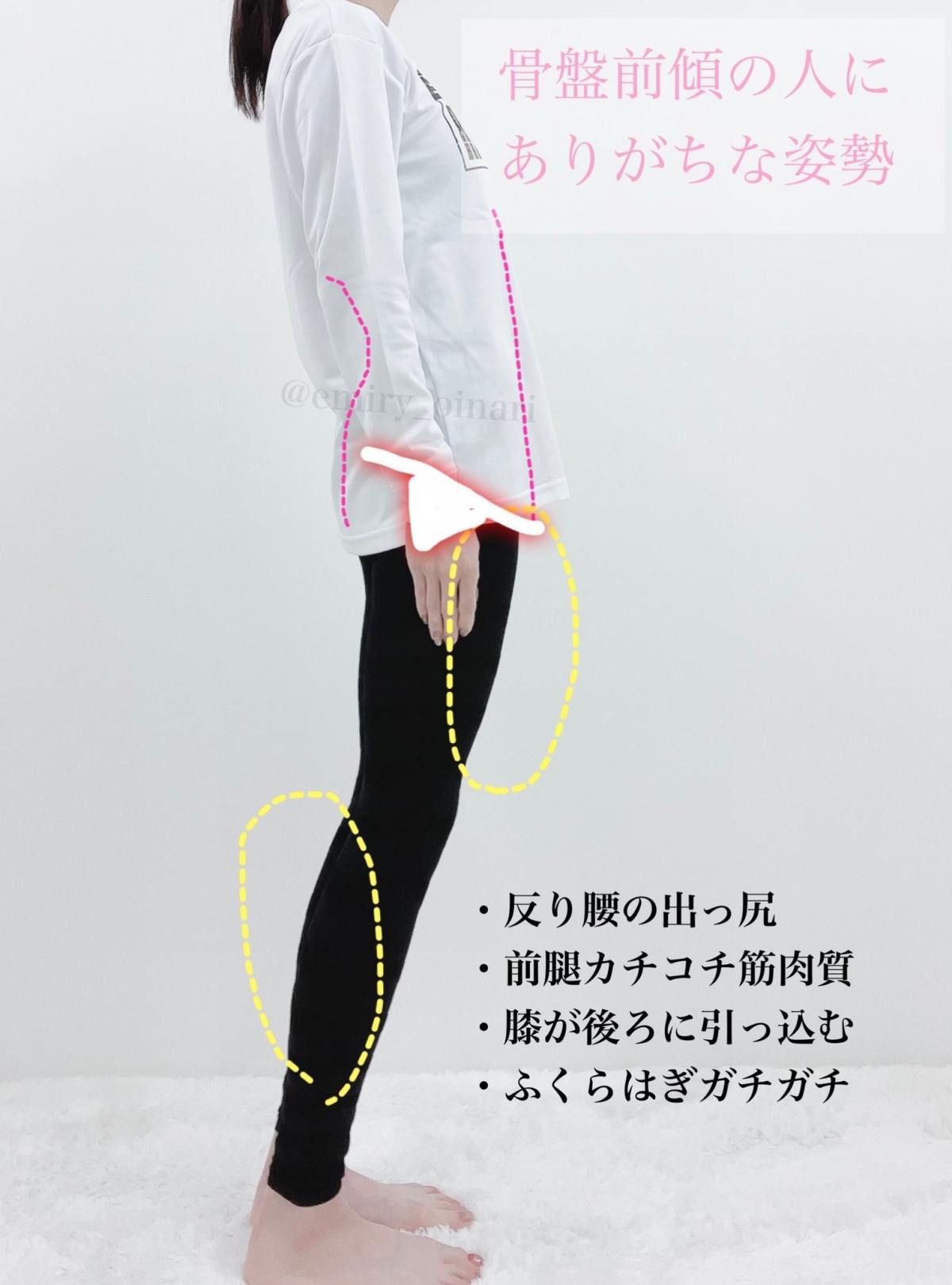 整體師親授3個 簡易拉筋動作 改善肩頸酸痛 O型腿 矯正骨盤歪斜問題 美化身體線條 Girlstyle 女生日常