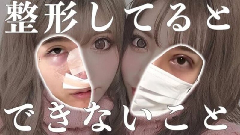 這對被網民稱為「人造姊妹花」的瘋狂整容和價值觀也引來爭議，不過也吸引了不少人前來觀看她們的影片。有關整容的影片也十分赤裸，雖然沒有手術過程，但是手術儀器和傷口也十分驚嚇。