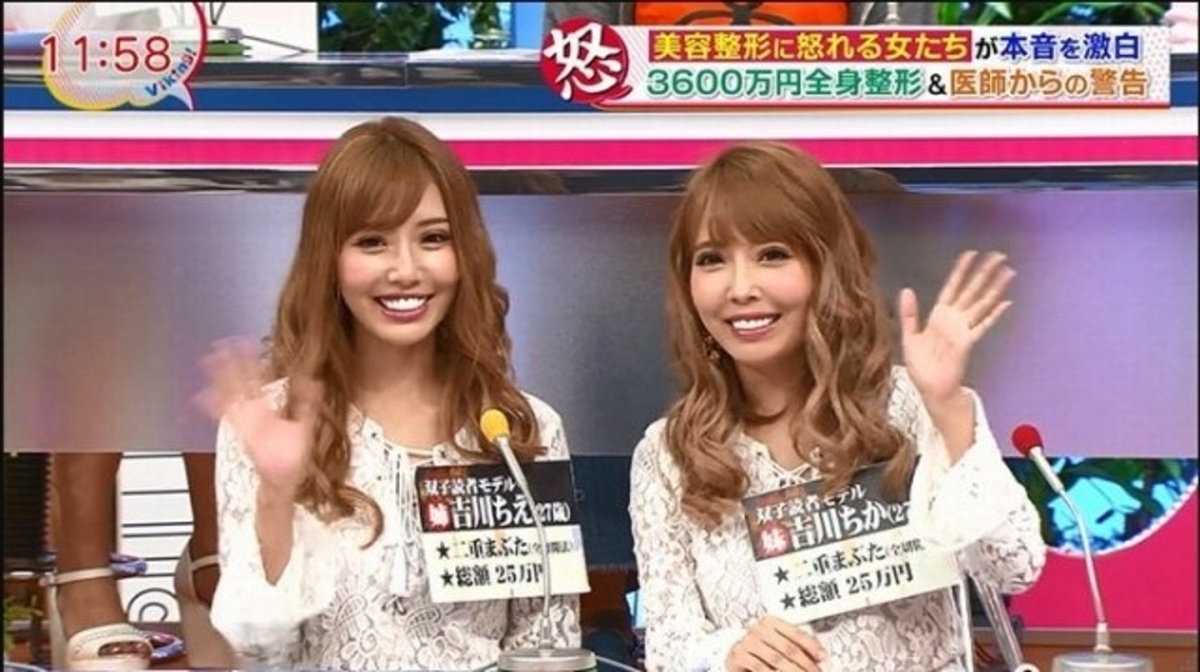 網民的意見其實也很兩極，有人認為現在的確比以前漂亮很多。而且有人覺得她們在網上分享過來人的經歷，也能幫助到更多有意想整容的女生，也絕非一件負面的事。