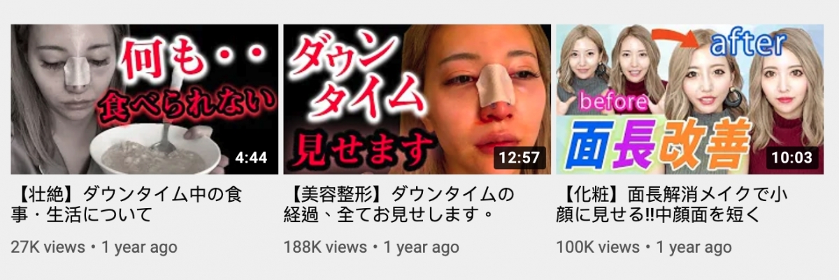 吉川千惠、吉川千加沈迷整容，在8年間無數次的整容，單是姐姐千惠的整容手術就耗資了$1000萬日元（約$80萬港元），可說是整容成癮。當中也接受過削骨、隆鼻、開眼頭、豐唇等手術等，長相愈來愈精緻。