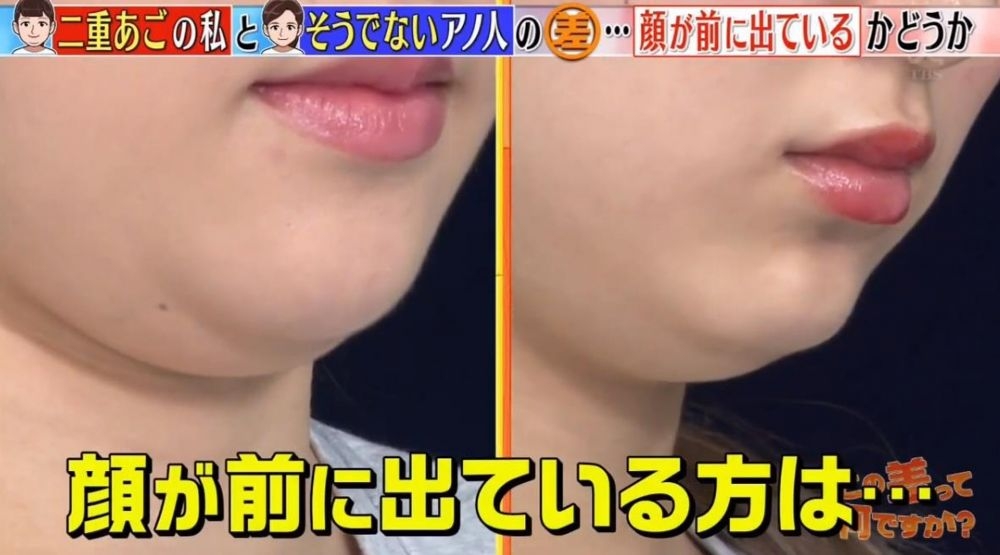 下巴也會慢慢變得鬆弛,變成超顯肥贅肉,即使是尖臉的人也無一例外~