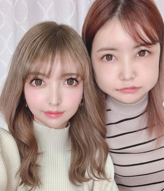 姐姐千惠在2個月前就有最新的一次削骨手術，改善面型輪廓。術後復康時，臉型也腫得像麵包，和妹妹合照時一點也不像。