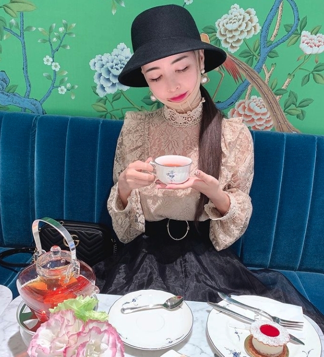 她們現在已經會把整容當平常事，會把術後的腫脹臉型和傷口都公開，更會戴著固定器去參加生日會或high tea。