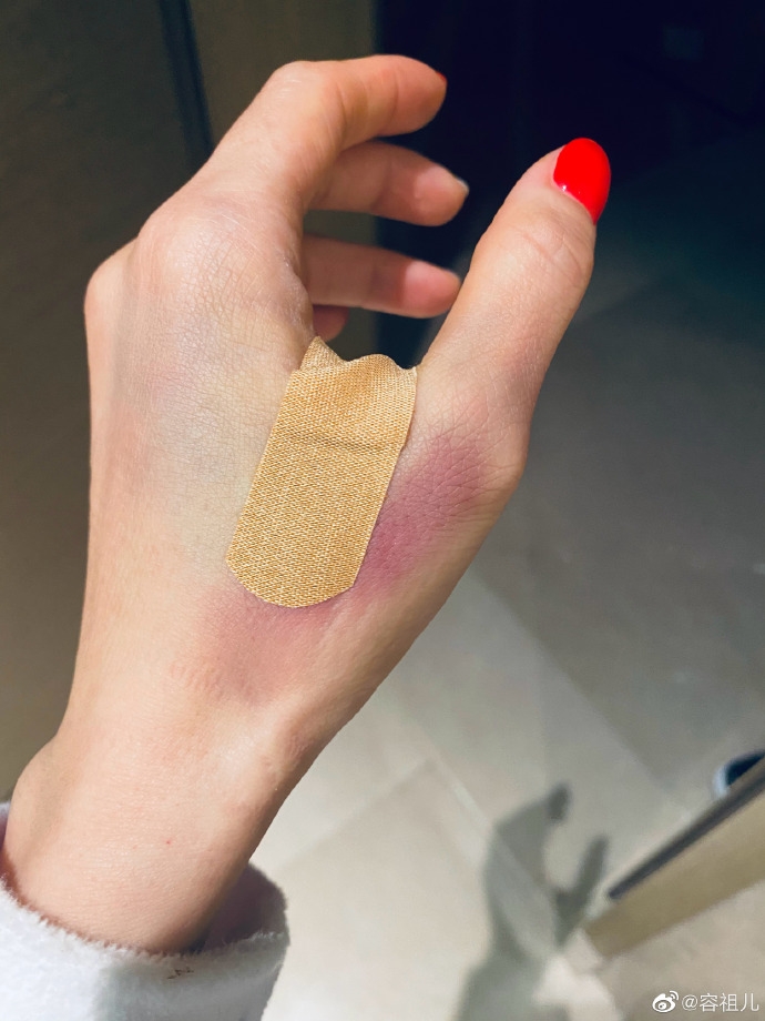 容祖兒Gel「長甲」變廢人釀意外,因美甲行動不便終被剪刀誤傷虎口